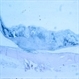 Toxocariasis